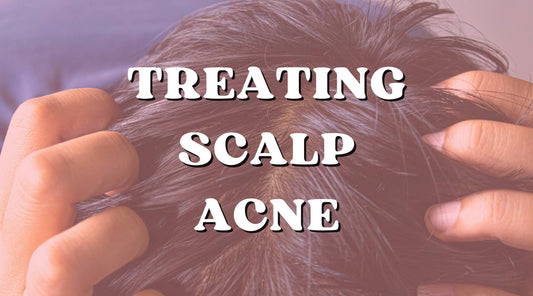 Scalp Acne: How to Treat and Soothe It Off? - Private Label