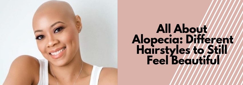 all about alopecia
