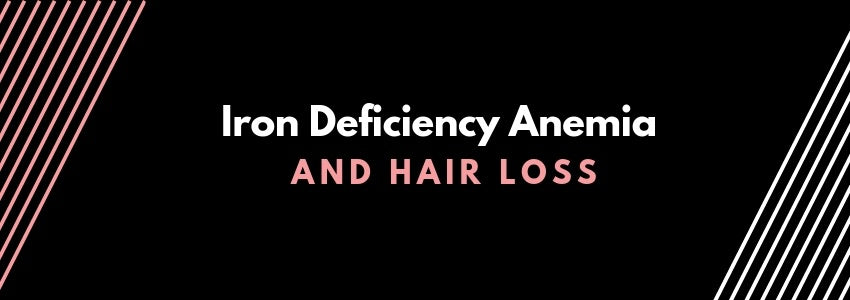 iron deficiency anemia and hair loss